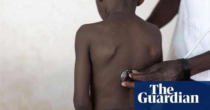 Jutaan remaja di Afrika menderita asma yang tidak terdiagnosis, penelitian mengungkapkan perkembangan global

